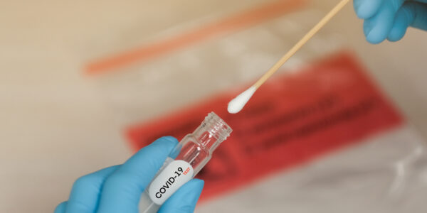 Image related to Additional temporary mobile testing available in Oxford