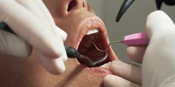 Dental Care